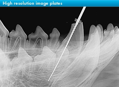 High resolution image plate for dental x-ray